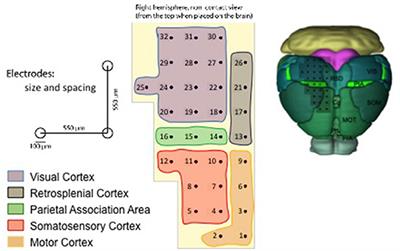 Analysis Pipeline for Extracting Features of Cortical Slow Oscillations